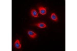 Immunofluorescent analysis of RPS6 staining in HeLa cells. (RPS6 antibody  (C-Term))