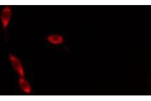 ABIN6276306 staining  Hela cells by IF/ICC. (Cytochrome C antibody  (N-Term))