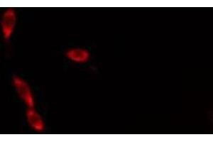 Immunofluorescence (fixed cells) (IF/ICC) image for anti-Cytochrome C, Somatic (CYCS) (N-Term) antibody (ABIN6261159)