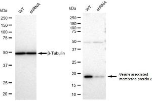 Western blotting analysis using Vesicle associated membrane protein 2 antibody (ABIN7800830).