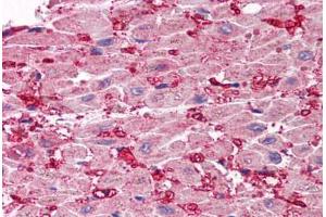 Human Heart (formalin-fixed, paraffin-embedded) stained with SCO1 antibody ABIN214471 at 2. (SCO1 antibody  (Internal Region))