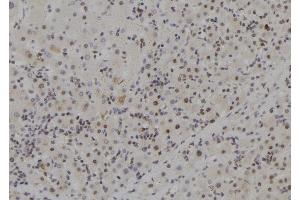 ABIN6257825 and ABIN6273704 at 1/100 staining Human liver tissue by IHC-P. (MCM9 antibody  (C-Term))
