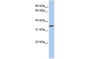 Western Blotting (WB) image for anti-Hydroxyacyl-CoA Dehydrogenase (HADH) antibody (ABIN2459806) (HADH antibody)
