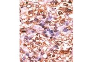 Image no. 2 for anti-Retinoblastoma 1 (RB1) (pSer788) antibody (ABIN358214) (Retinoblastoma 1 antibody  (pSer788))
