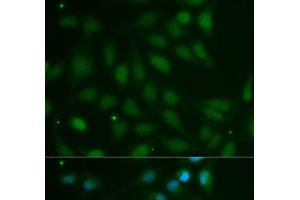 Immunofluorescence analysis of MCF-7 cells using ABO Polyclonal Antibody (ABO antibody)