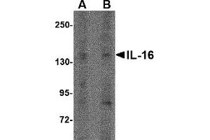 Western Blotting (WB) image for anti-Interleukin 16 (IL16) (N-Term) antibody (ABIN1031408) (IL16 antibody  (N-Term))