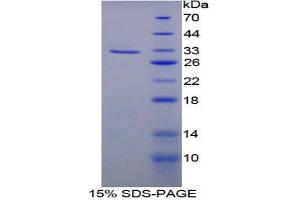 SDS-PAGE analysis of Rat Fatty Acid Synthase Protein. (Fatty Acid Synthase Protein (FASN))