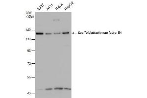 WB Image Various whole cell extracts (30 μg) were separated by 7. (SAFB antibody)