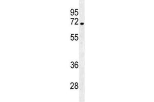 NUMB antibody western blot analysis in NCI-H292 lysate. (NUMB antibody  (AA 1-30))