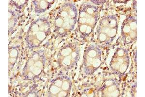 Immunohistochemistry of paraffin-embedded human colon tissue using ABIN7158817 at dilution of 1:100