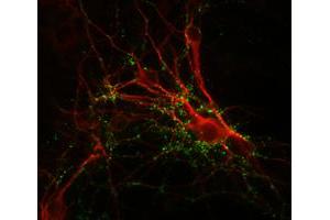 Immunochemical staining of cultured caudate neurons with SYN1 polyclonal antibody  (green) and anti-MAP antibody (red).