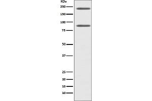 Western blot analysis of C4 expression in HepG2 cell lysate.