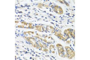Immunohistochemistry of paraffin-embedded human stomach using IL11 antibody at dilution of 1:100 (40x lens). (IL-11 antibody)
