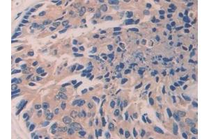 Immunohistochemistry (IHC) image for anti-Integrin beta 1 (ITGB1) (AA 140-383) antibody (ABIN7433060)