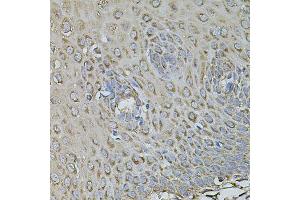Immunohistochemistry of paraffin-embedded human esophagus using FDX1 antibody (ABIN6003547) at dilution of 1/100 (40x lens).