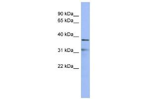 WB Suggested Anti-HEY2 Antibody Titration:  0. (HEY2 antibody  (Middle Region))