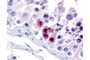 Immunohistochemistry (IHC) image for anti-RAR-Related Orphan Receptor C (RORC) (N-Term) antibody (ABIN2782284) (RORC antibody  (N-Term))