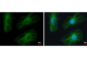 ICC/IF Image TUBB2A antibody detects TUBB2A protein at cytoskeleton by immunofluorescent analysis. (TUBB2A antibody)