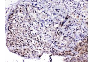 IHC analysis of MED15 using anti-MED15 antibody . (MED15 antibody  (AA 1-285))