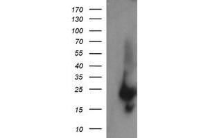 Image no. 1 for anti-RAB37, Member RAS Oncogene Family (RAB37) antibody (ABIN1500562) (RAB37 antibody)