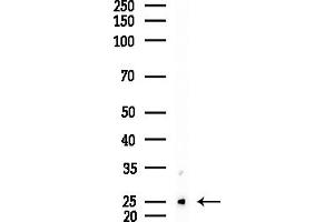 anti-Ubiquitin-Conjugating Enzyme E2D 1 (UBE2D1) (C-Term) antibody
