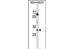 Western blot analysis in MDA-MB231 cell line lysates (35ug/lane). (Lactate Dehydrogenase A antibody  (C-Term))