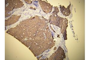 Immunohistochemistry (IHC) image for anti-Keratin 19 (KRT19) (AA 386-399), (C-Term) antibody (ABIN870579) (Cytokeratin 19 antibody  (C-Term))