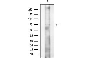 anti-CDK5 Regulatory Subunit Associated Protein 1 (CDK5RAP1) (C-Term) antibody