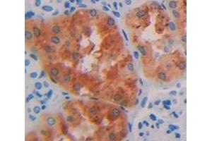 Figure. (HGD antibody  (AA 239-428))