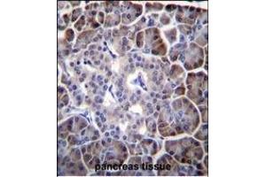 Immunohistochemistry (Paraffin-embedded Sections) (IHC (p)) image for anti-Myosin Binding Protein H-Like (MYBPHL) (AA 80-108), (N-Term) antibody (ABIN655765)