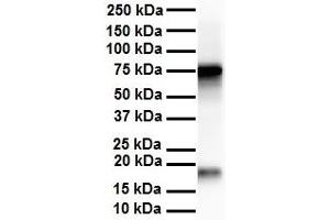 WB Suggested Anti-APEH antibody Titration: 1 ug/mL Sample Type: Human liver (APEH antibody  (N-Term))
