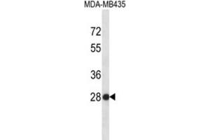 Western Blotting (WB) image for anti-Small Nuclear Ribonucleoprotein Polypeptide B (SNRPB2) antibody (ABIN2996703) (SNRPB2 antibody)