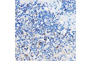 Immunohistochemistry of paraffin-embedded Human spleen using HC Rabbit pAb (ABIN7267805) at dilution of 1:100 (40x lens). (GPR109B antibody)