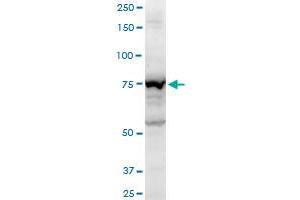 AMOT polyclonal antibody (A01), Lot # 060613JCS1. (Angiomotin antibody  (AA 361-460))