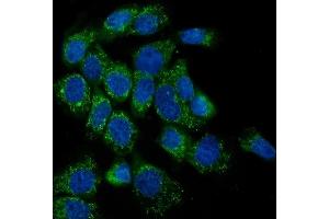 IF analysis of LPP using anti-LPP antibody (ABIN7599606). (LPP antibody  (AA 10-572))