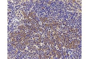Immunohistochemistry analysis of paraffin-embedded mouse spleen using CD284 Polyclonal Antibody at dilution of 1:1000. (TLR4 antibody)