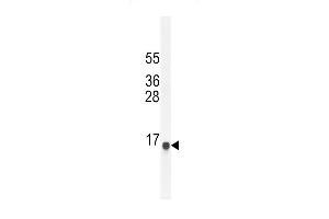 SG11A Antibody (N-term) (ABIN654791 and ABIN2844469) western blot analysis in NCI- cell line lysates (35 μg/lane). (SPAG11A antibody  (N-Term))