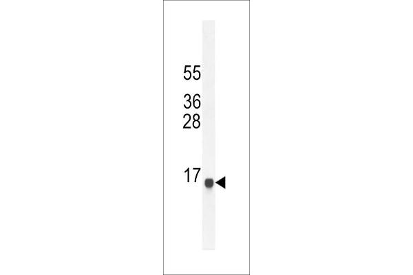 SPAG11A Antikörper  (N-Term)