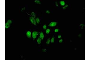 Immunofluorescent analysis of A549 cells using ABIN7163478 at dilution of 1:100 and Alexa Fluor 488-congugated AffiniPure Goat Anti-Rabbit IgG(H+L) (PIWIL4 antibody  (AA 12-235))