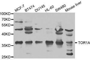 Western blot analysis of extracts of various cell lines, using TOR1A antibody. (TOR1A antibody)