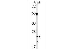 Western blot analysis of C1QA antibody in Jurkat cell line lysates (35ug/lane)