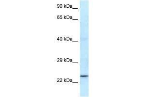 WB Suggested Anti-Rnf141 Antibody Titration: 1. (RNF141 antibody  (N-Term))