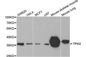 Western blot analysis of extracts of various cell lines, using TPM2 antibody.