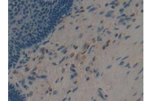 IHC-P analysis of Human Esophagus Tissue, with DAB staining. (Apolipoprotein F antibody  (AA 122-307))