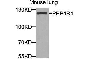 Western blot analysis of extracts of mouse lung, using PPP4R4 antibody (ABIN5974913) at 1/1000 dilution.