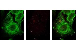 Immunohistochemistry. (GLI3 antibody  (AA 30-60))