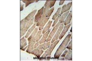 SLC9A9 Antibody (C-term) (ABIN651604 and ABIN2840319) immunohistochemistry analysis in formalin fixed and paraffin embedded human skeletal muscle followed by peroxidase conjugation of the secondary antibody and DAB staining.