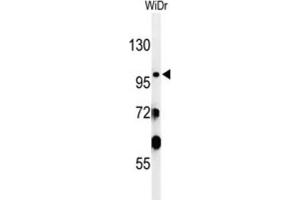 Western Blotting (WB) image for anti-Vacuolar Protein Sorting 52 Homolog (VPS52) antibody (ABIN3002120)