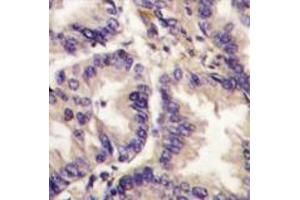 Image no. 2 for anti-Vascular Endothelial Growth Factor C (VEGFC) (AA 255-285), (Middle Region) antibody (ABIN357425)