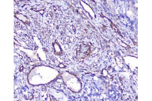 IHC analysis of INPPL1 using anti-INPPL1 antibody (ABIN6719492). (INPPL1 antibody  (AA 1172-1258))